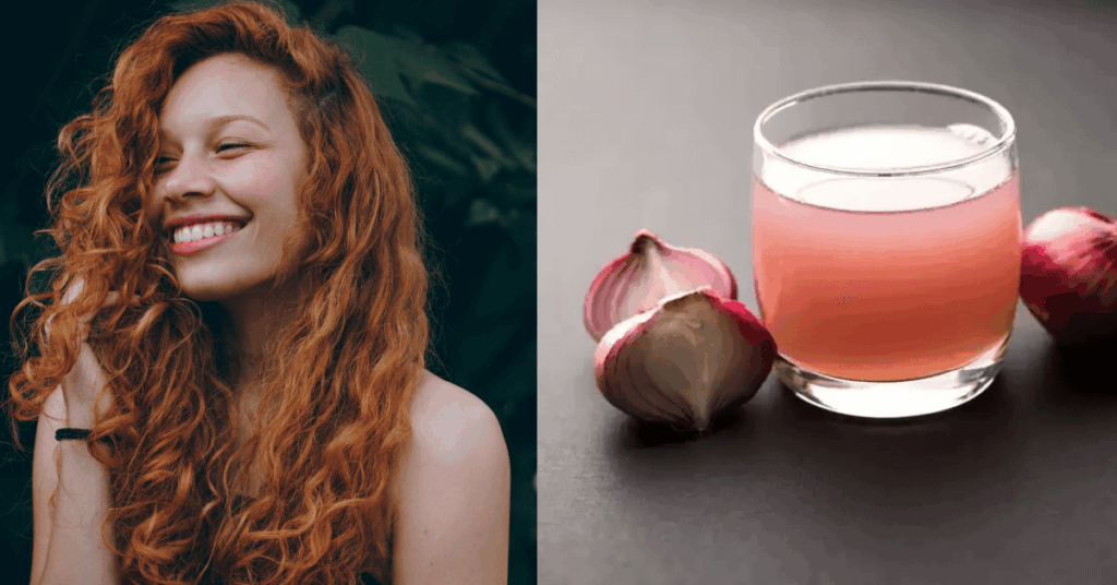 2. Onion Juice Yes, It Smells; But It Works as natural hair growth remedy